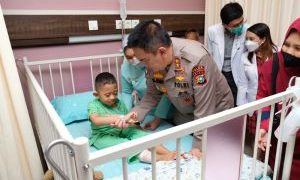 Kapolda Riau Jenguk Kakak Beradik Penderita Rapuh Tulang